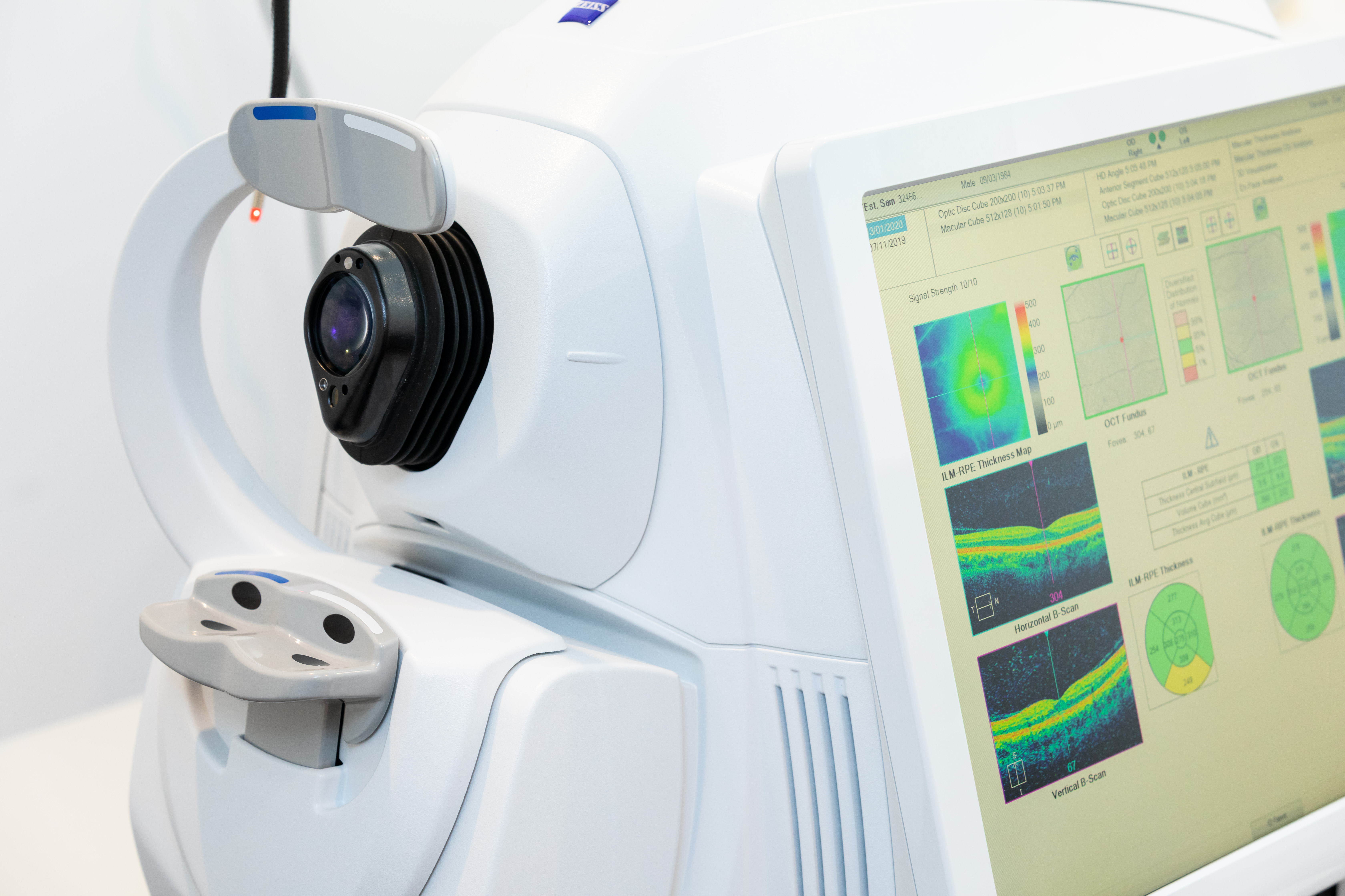OCT scanner displaying detailed retinal imaging results
